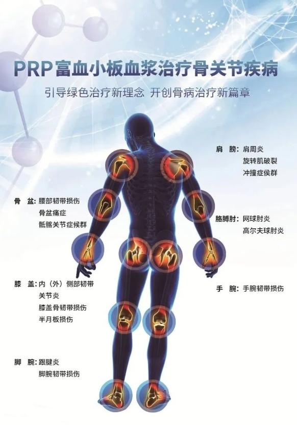 prpapo区别 prp prf区别 