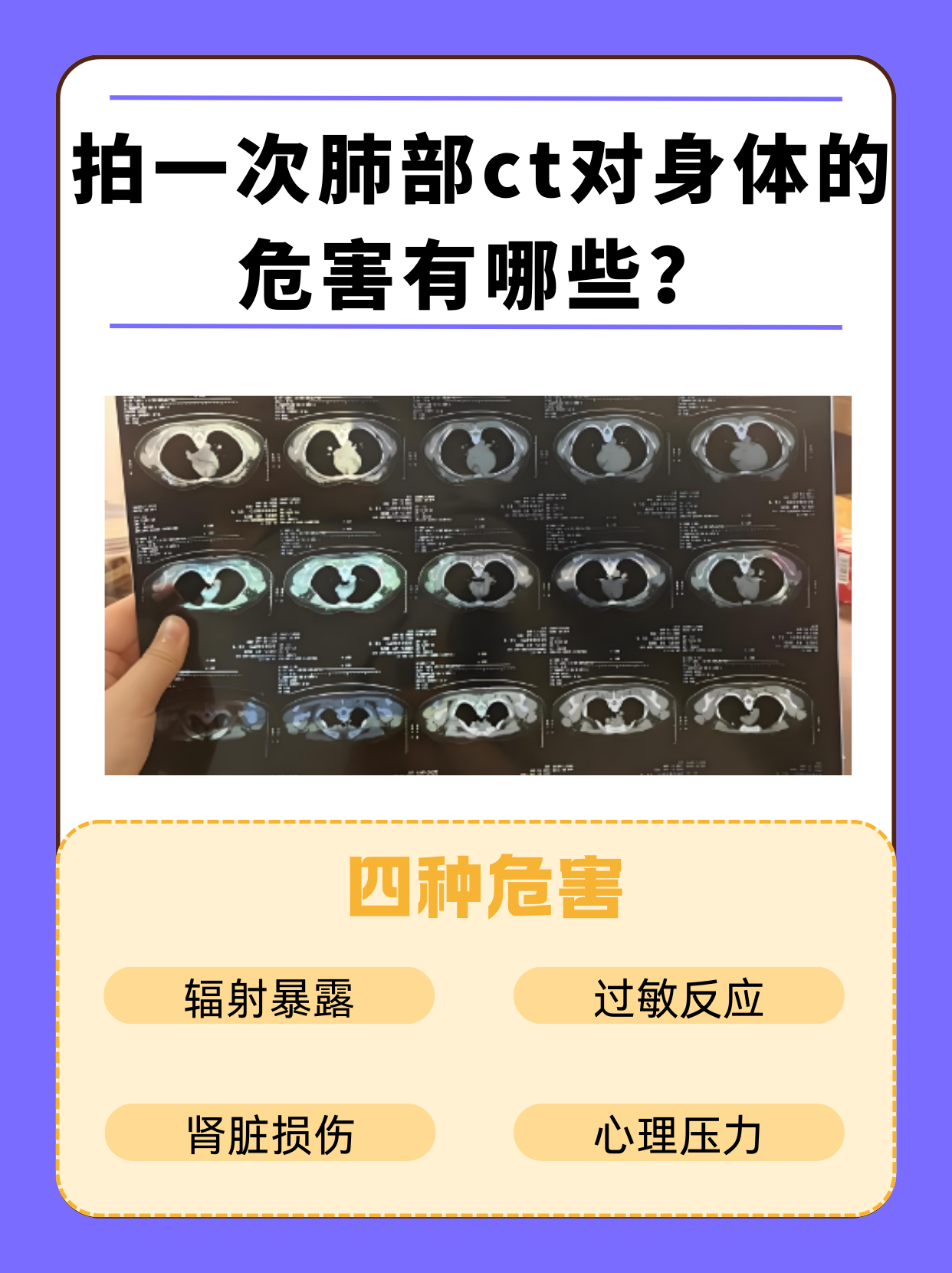 ct和cte的区别 ct和ct有什么区别 