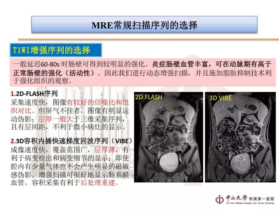 ct和cte的区别 ct和ct有什么区别 