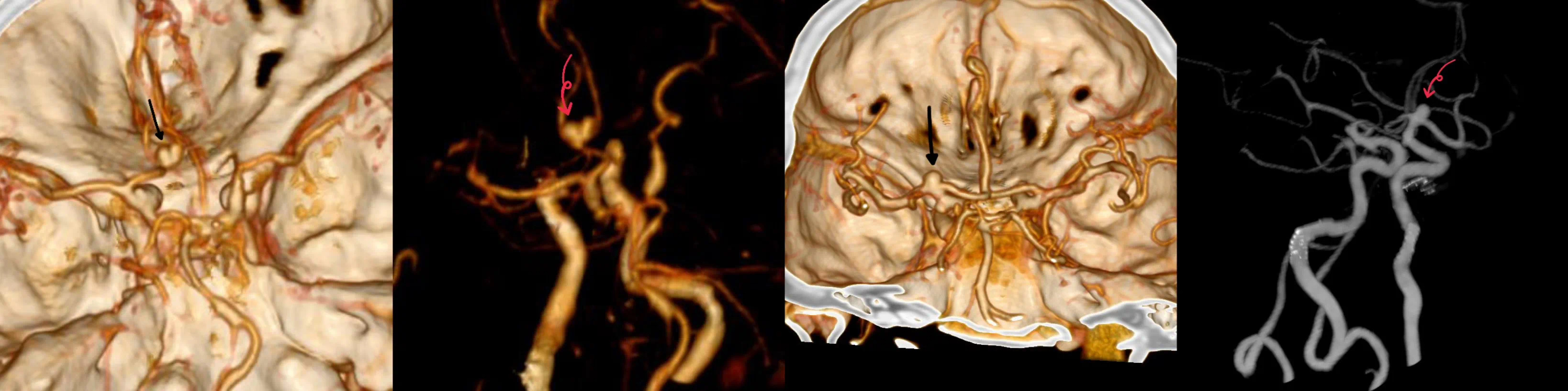 ctp和rtp区别 ctp与ctq的区别 ctp和rtp区别 ctp与ctq的区别