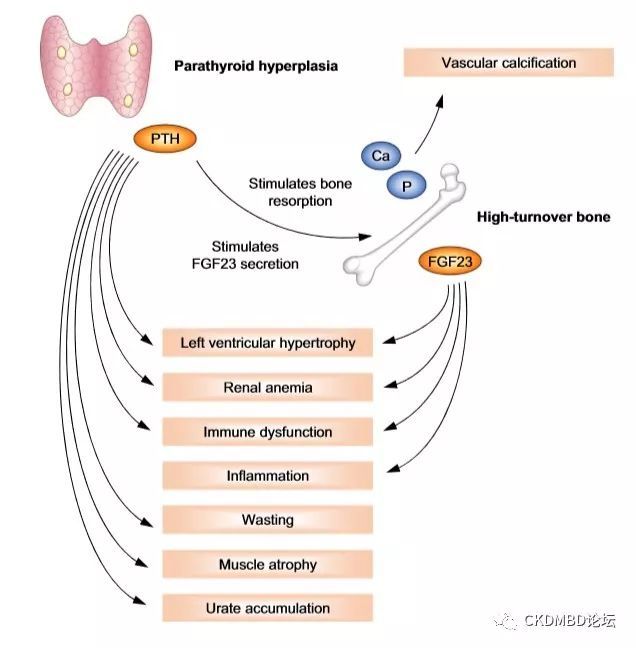 pt和pth区别 pt与pd有什么区别 pt和pth区别 pt与pd有什么区别