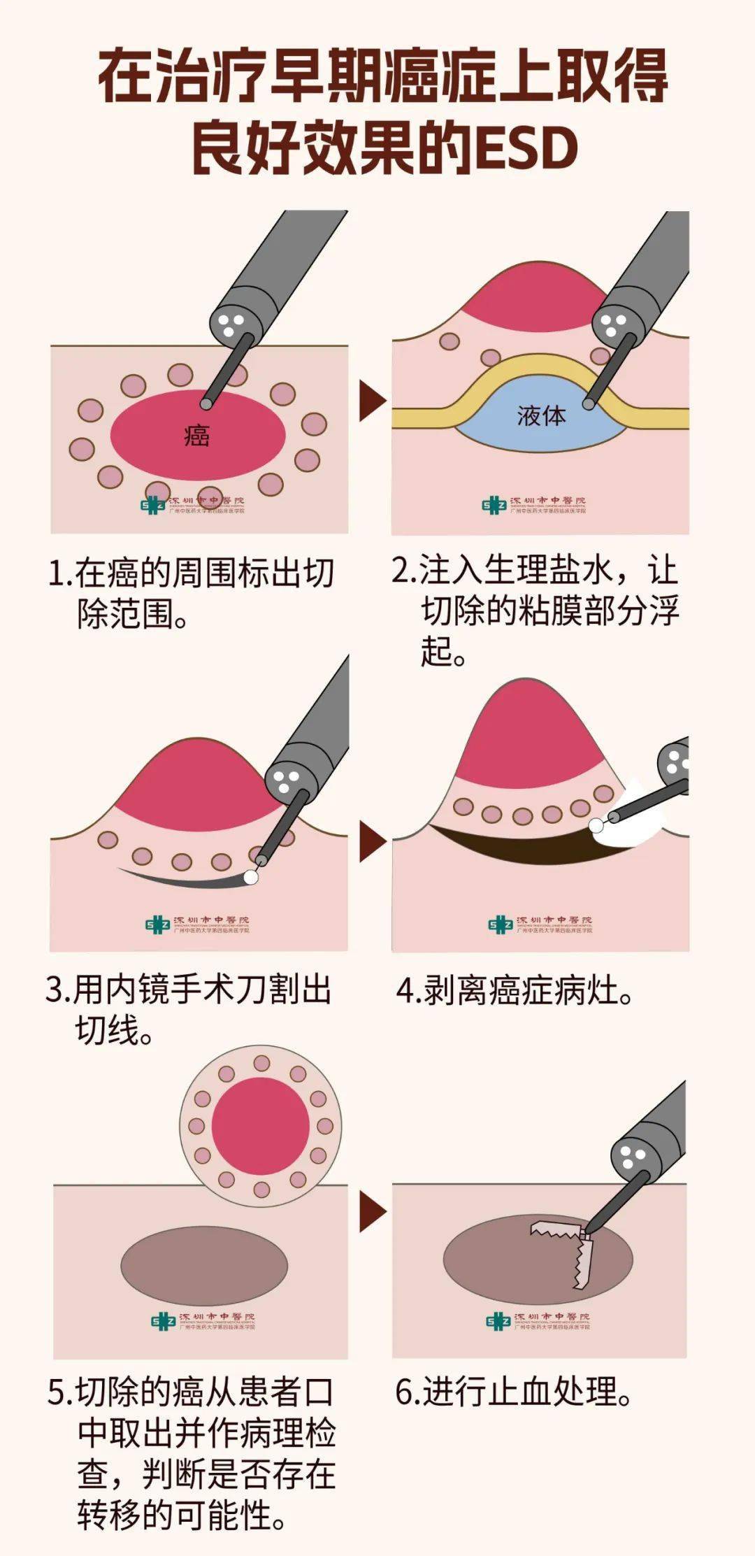 gho与esd的区别 esd文件和gho文件一样吗 gho与esd的区别 esd文件和gho文件一样吗